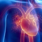 Insuffisance cardiaque